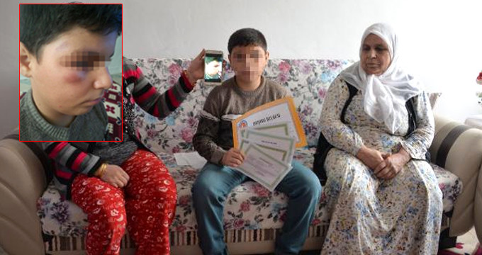 Öğretmeninden Dayak Yiyen Öğrenci, Şikayetini Geri Almayınca Okuldan Uzaklaştırıldı