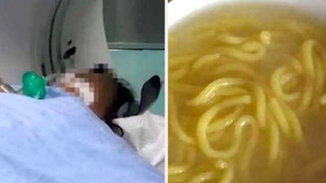 Dondurucudan Çıkardıkları Erişteyi Yiyen Aynı Aileden 9 Kişi Hayatını Kaybetti