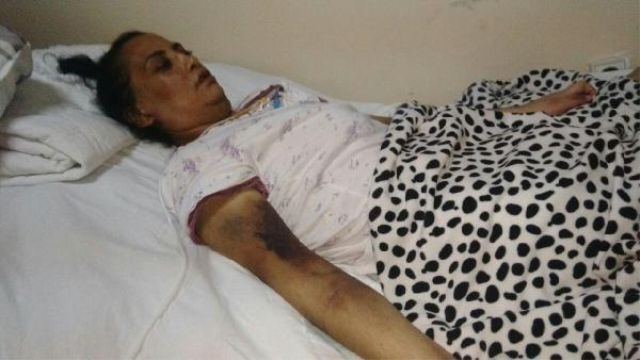 Aşırı kilolarından Kurtulmak İçin Ameliyat Oldu, Felç Geçirdi