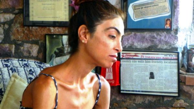 Prenses Hastalığına Yakalandı, 66 Kilodan 38 Kiloya Düştü, Aynalara Küstü